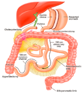 TÉCNICA-DE-MARCEAU TÉCNICA-DE-MARCEAU